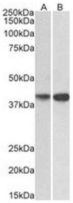 Western Blot: ENDOGL1 Antibody [NBP2-44323]