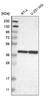 Western Blot: ENDOGL1 Antibody [NBP2-62597]