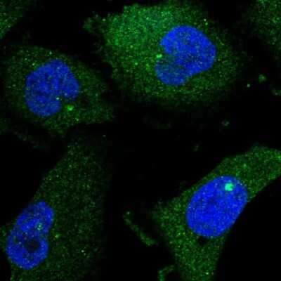 Immunocytochemistry/ Immunofluorescence: ENGASE Antibody [NBP1-93948]