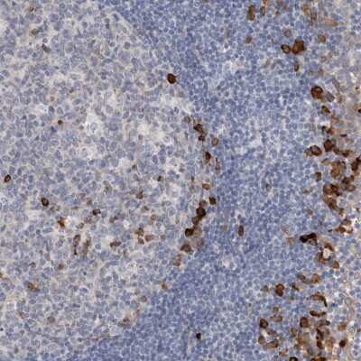 Immunohistochemistry-Paraffin: ENGASE Antibody [NBP1-93948]