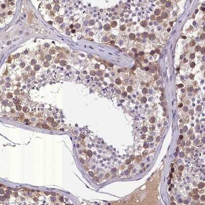 Immunohistochemistry-Paraffin: ENKD1 Antibody [NBP1-85147]