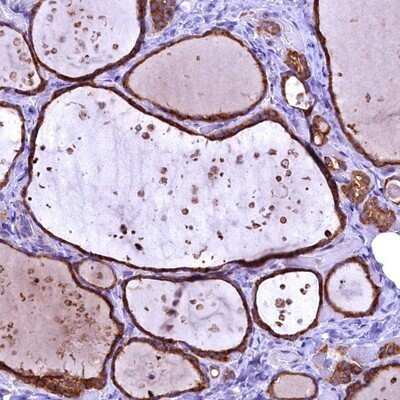 Immunohistochemistry-Paraffin: ENKD1 Antibody [NBP1-85148]