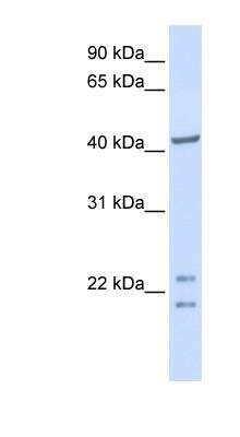 Western Blot: ENKD1 Antibody [NBP1-56350]