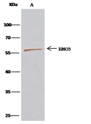 Immunoprecipitation: ENO3 Antibody (003) [NBP2-90274]