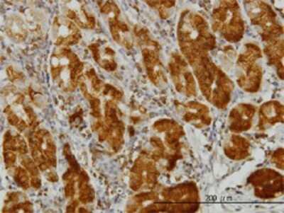 Immunohistochemistry-Paraffin: ENO3 Antibody (5D1) [H00002027-M01]