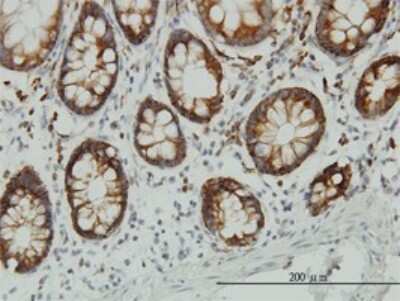 Immunohistochemistry-Paraffin: ENO3 Antibody (5D1) [H00002027-M01]