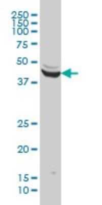 Western Blot: ENO3 Antibody (5D1) [H00002027-M01]