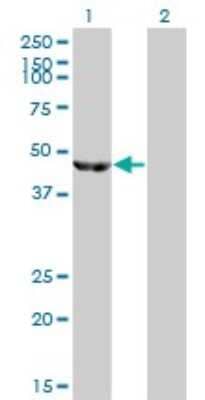 Western Blot: ENO3 Antibody (5D1) [H00002027-M01]