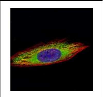 Immunocytochemistry/ Immunofluorescence: ENO3 Antibody [NBP2-16336]
