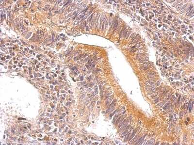 Immunohistochemistry-Paraffin: ENO3 Antibody [NBP1-31764]