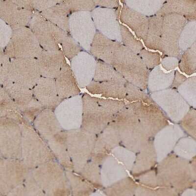 Immunohistochemistry-Paraffin: ENO3 Antibody [NBP1-85821]