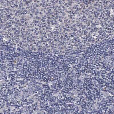 Immunohistochemistry-Paraffin: ENO3 Antibody [NBP1-85821]