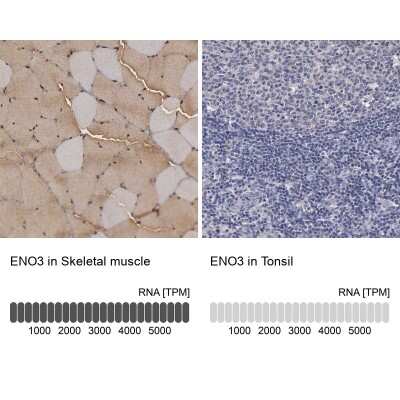 Immunohistochemistry-Paraffin: ENO3 Antibody [NBP1-85821]