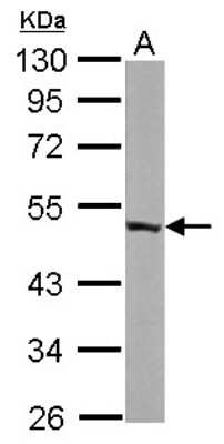 Western Blot: ENO3 Antibody [NBP1-31764]