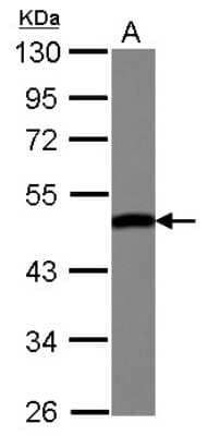 Western Blot: ENO3 Antibody [NBP2-16336]