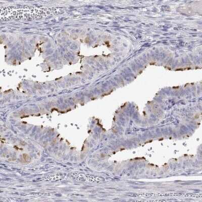 Immunohistochemistry-Paraffin: ENO4 Antibody [NBP2-38927]