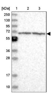 Western Blot: ENO4 Antibody [NBP2-38373]