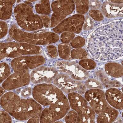 Immunohistochemistry-Paraffin: ENOSF1 Antibody [NBP2-13962]