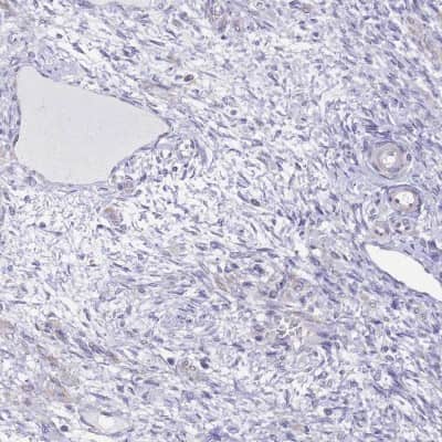 Immunohistochemistry-Paraffin: ENOSF1 Antibody [NBP2-13962]