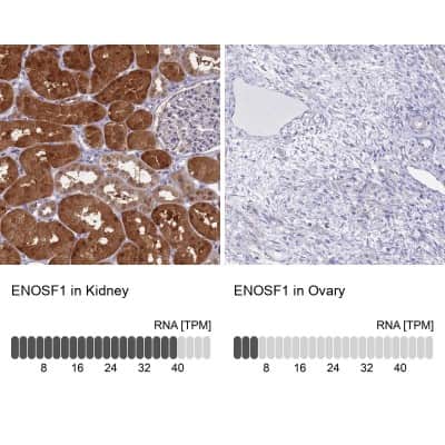 Immunohistochemistry-Paraffin: ENOSF1 Antibody [NBP2-13962]