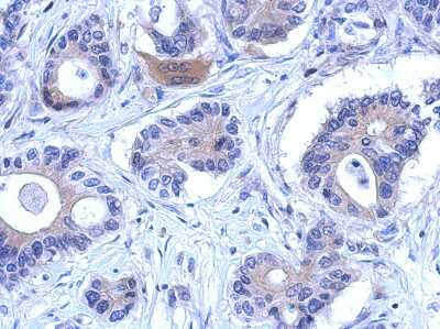 Immunohistochemistry-Paraffin: ENOSF1 Antibody [NBP2-16338]