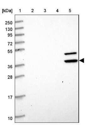 Western Blot: ENOSF1 Antibody [NBP2-13962]