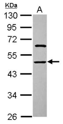 Western Blot: ENOSF1 Antibody [NBP2-16338]