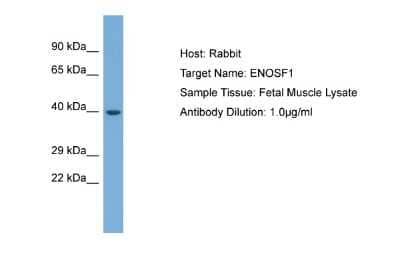 Western Blot: ENOSF1 Antibody [NBP2-87361]