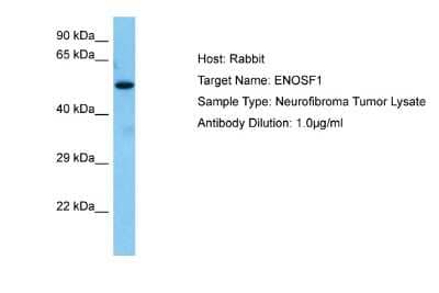 Western Blot: ENOSF1 Antibody [NBP2-87362]