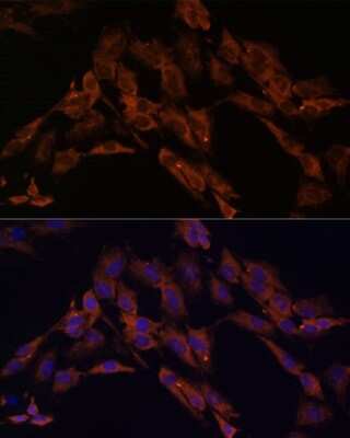 Immunocytochemistry/ Immunofluorescence: ENOX2 Antibody - Azide and BSA Free [NBP3-05024]