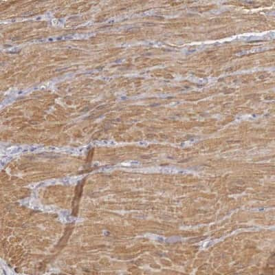 Immunohistochemistry-Paraffin: ENOX2 Antibody [NBP1-89038]