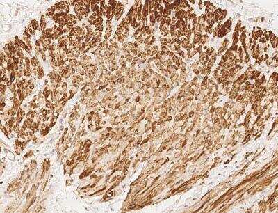 Immunohistochemistry-Paraffin: ENOX2 Antibody [NBP3-05824]