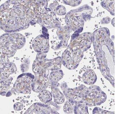 Immunohistochemistry-Paraffin: ENPP-1 Antibody [NBP2-38945]