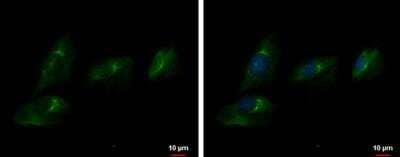 Immunocytochemistry/ Immunofluorescence: ENPP-2/Autotaxin Antibody [NBP1-32162]