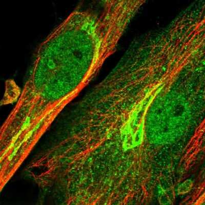 Immunocytochemistry/ Immunofluorescence: ENPP-2/Autotaxin Antibody [NBP2-58482]