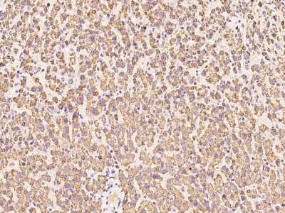 Immunohistochemistry-Paraffin: ENPP-2/Autotaxin Antibody [NBP2-99772]