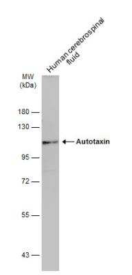 Western Blot: ENPP-2/Autotaxin Antibody [NBP2-16339]