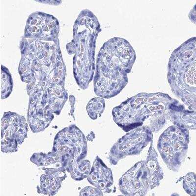 Immunohistochemistry-Paraffin: ENPP-3/CD203c Antibody [NBP1-88928]