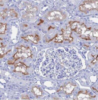 Immunohistochemistry-Paraffin: ENPP-3/CD203c Antibody [NBP1-88928]