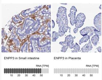 Immunohistochemistry-Paraffin: ENPP-3/CD203c Antibody [NBP1-88928]