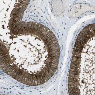 Immunohistochemistry-Paraffin: ENPP-5 Antibody [NBP1-86449]
