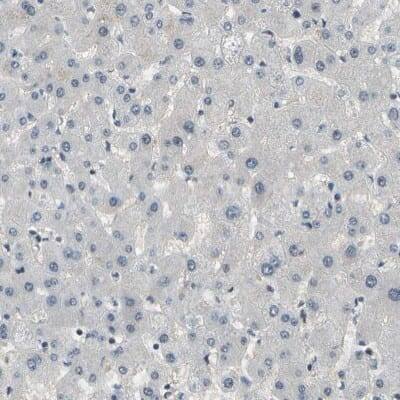 Immunohistochemistry-Paraffin: ENPP-5 Antibody [NBP1-86449]