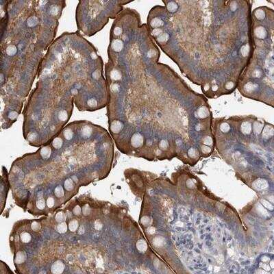 Immunohistochemistry: ENPP-7/Alk-SMase Antibody [NBP1-89138]