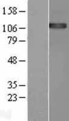 Western Blot: ENPP-1 Overexpression Lysate [NBL1-10273]