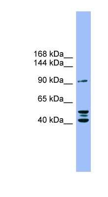 Western Blot: ENPP-2/Autotaxin Antibody [NBP1-59852]