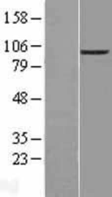 Western Blot: ENPP-2/Autotaxin Overexpression Lysate [NBL1-10275]