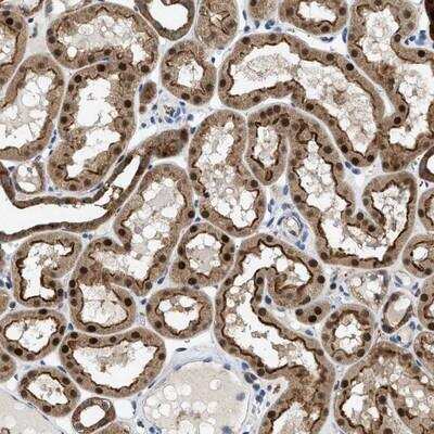 Immunohistochemistry-Paraffin: ENPP-4 Antibody [NBP1-81466]