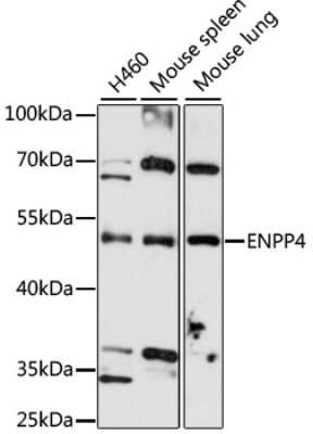 Western Blot: ENPP-4 AntibodyAzide and BSA Free [NBP3-05178]