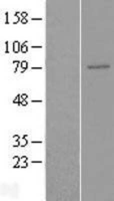 Western Blot: ENPP-5 Overexpression Lysate [NBP2-04386]