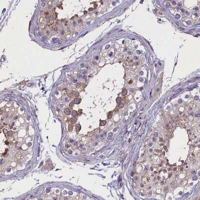 Immunohistochemistry-Paraffin: ENPP6 Antibody [NBP1-82710]